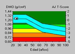 Ejemplo de los resultados de una densitometría